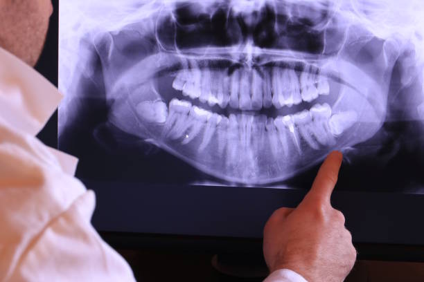 Best Dentist for Tooth Abscess  in Barry, IL