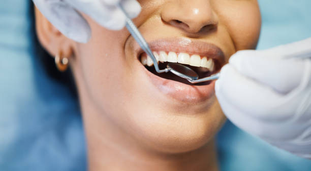 Best Cracked Tooth Emergency Dentist  in Barry, IL