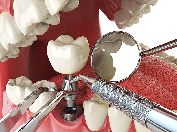 Best Dentist Open on Weekends  in Barry, IL
